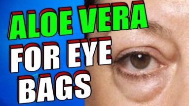 How To Get Rid Of Stubborn Eye Bags, Dark Circles & Wrinkles With Aloe Vera & Essential oils