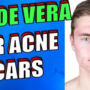 How To Use Aloe Vera OVERNIGHT To Treat Acne Scars, Pimples & Zits