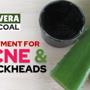 Treatment for Acne and Blackheads - Aloe Vera Mango and Activated Charcoal Face Mask